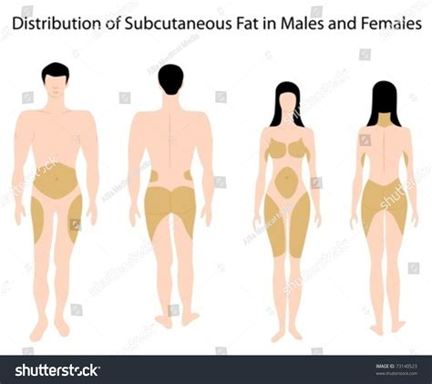 Subcutaneous Fat Distribution Human Stock Vector (Royalty Free) 73140523