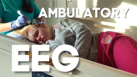 Ambulatory EEG What To Expect - YouTube