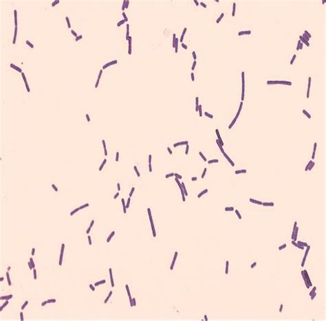 GRAM STAIN – Red Mountain Microbiology