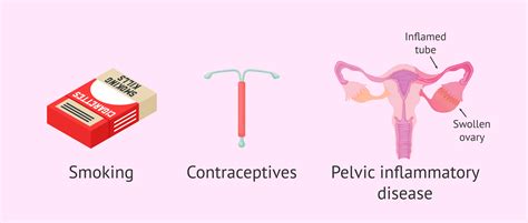 What are the causes and consequences of ectopic pregnancy?