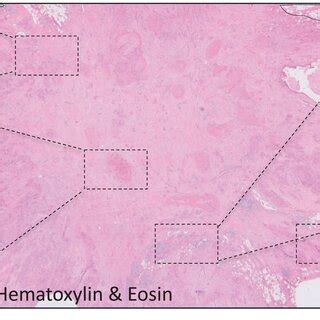 Histological representation of targetable stromal cells.... | Download ...