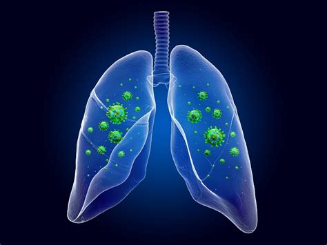 Bronchiolitis: Symptoms, Types, Causes, Diagnosis, and Treatment