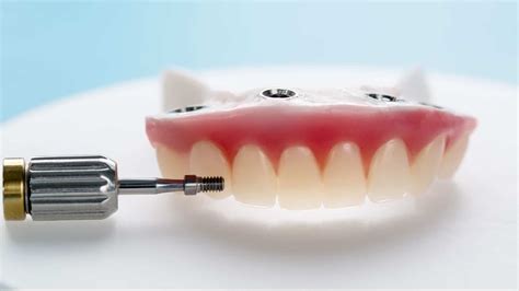 Zirconia Dental Implants: In Intro for Curious Patients