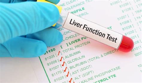 Decoding Liver Profile or Liver Tests - Dr Pathik Parikh