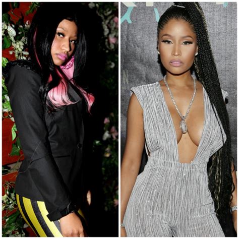 See Nicki Minaj Before and After Butt Implants and Nose Job Rumors