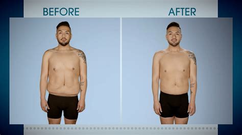 Tucked Up from Botched Patients Before and After: Shocking Transformations! | E! News