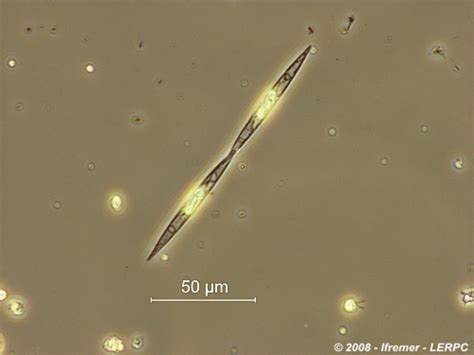 Pseudo-nitzschia - Unité Littoral