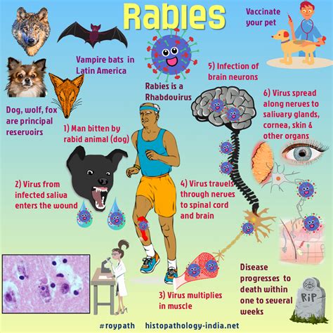 Pathology of Rabies | World rabies day, Animal bites, Pathology