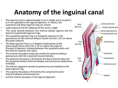 Boundaries Of Inguinal Canal Anatomy Of Inguinal Hernia The | Porn Sex Picture