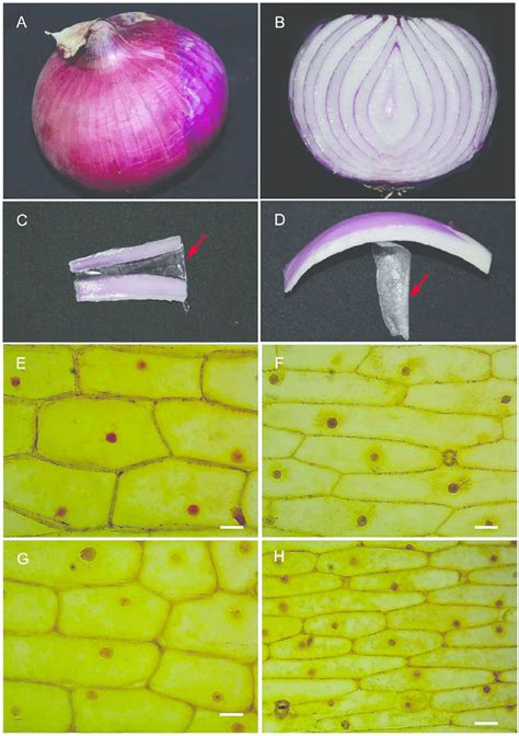 Onion Skin Cell Lpo