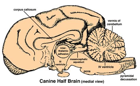 Sketch of a Bisected Brain