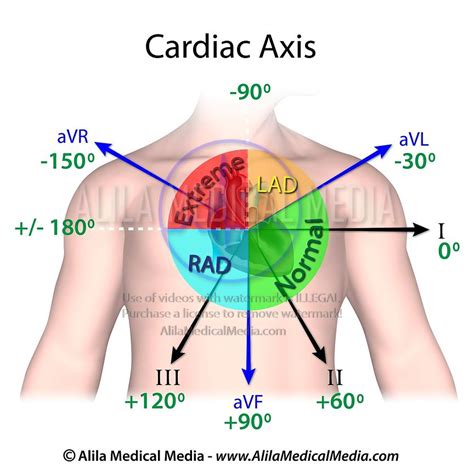 Alila Medical Media | Cardiac axis diagram | Medical illustration