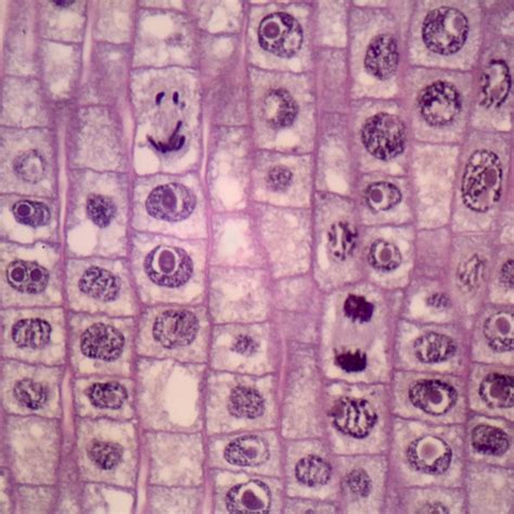 Onion Mitosis, l.s. Thin Microscope Slide | Carolina.com