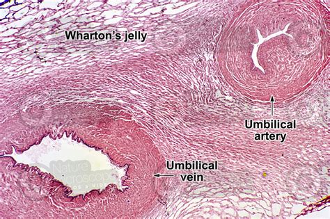 Mammal. Umbilical cord. Transverse section. 25X - Mammals - Mammals - Reproductive system ...