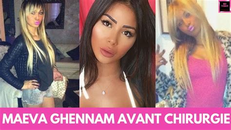 Maeva Ghennam Sans Chirurgie / Maeva Ghennam Ses Confidences Etonnantes Sur Sa Prochaine ...