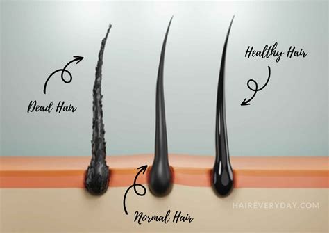 What Is Dead Hair And 7 Easy Ways You Can Bring Your Tresses Back To Life! - Hair Everyday Review