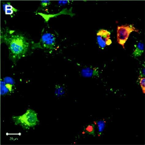 Visualization of apoptotic body engulfment by LX2 cells by fluorescence... | Download Scientific ...