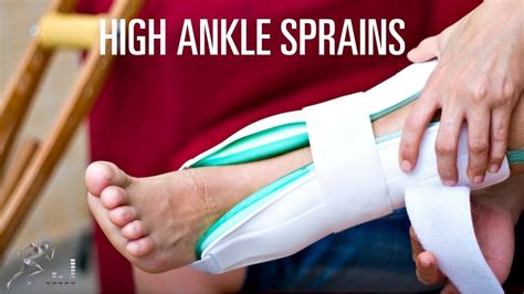 High Ankle Sprain Symptoms