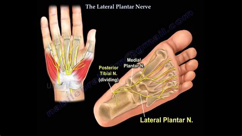 28+ Lateral Plantar Nerve Entrapment | RinniRomanos