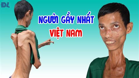 Phú đến chúc mừng anh chàng gầy nhất Việt Nam được tặng nhà mới - ĐỘC LẠ BÌNH DƯƠNG - YouTube