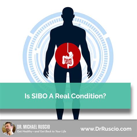 Is SIBO a Real Condition?