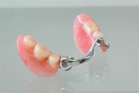 What Are Flexible Partial Dentures? - Sarasota Dentistry