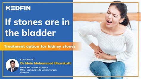 Treatment options for Bladder stones - YouTube