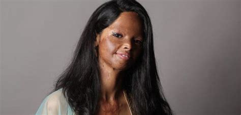 Acid Attack Survivors