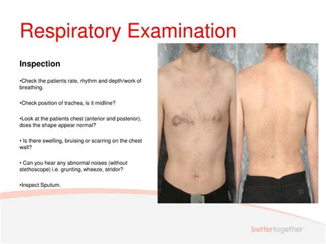 PPT - UWE Bristol Respiratory Examination PowerPoint Presentation, free download - ID:1788261