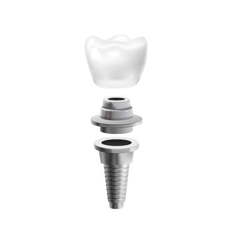 Best Dental Implants clinic | Dental Implants cost in India