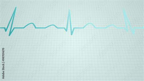 Animation of a schematic diagram of normal sinus rhythm for a human heart vídeo de Stock | Adobe ...