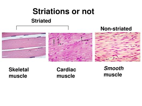 Non Striated Voluntary Muscle