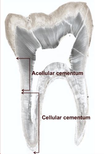 Histology of Dentin and Cementum Flashcards | Quizlet