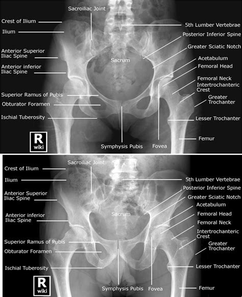 Male and Female Pelvis Anatomy