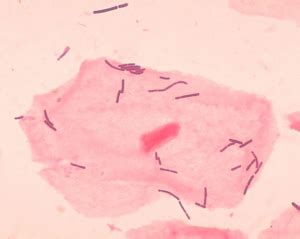 Gram stain of Lactobacilli | Medical Laboratories