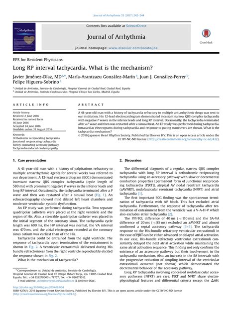 (PDF) Long RP interval tachycardia. What is the mechanism?