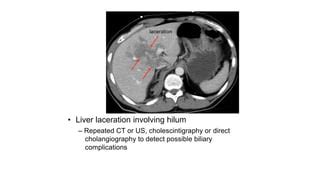 Abnormal abdominal ct ppt slide | PPT