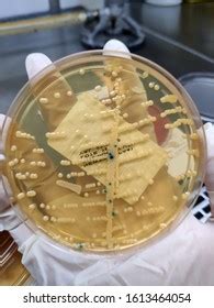 Staphylococcus Saprophyticus Sample Culture Microbiology Stock Photo ...