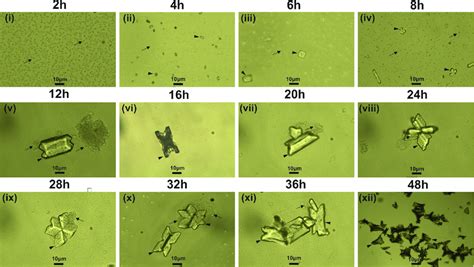 Temporal growth pattern of struvite crystals grown in artificial urine ...