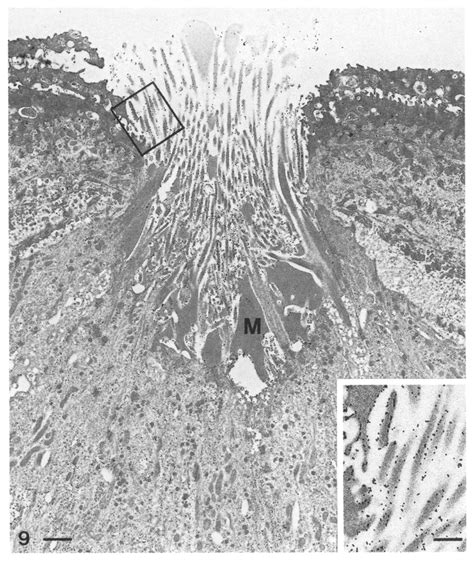 Taste pore region with numerous microvilli, which exhibit dense... | Download Scientific Diagram