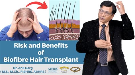 Biofibre Hair Transplant | Hair Transplant in India | Best Clinic For ...