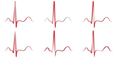 Ekg Line PNG Transparent Images Free Download | Vector Files | Pngtree