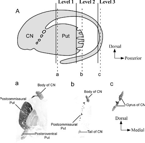 A, schematic drawing of a sagittal view of the human striatum (CN and... | Download Scientific ...