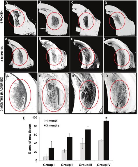 Micro-CT reconstruction images. Representative micro-CT reconstruction... | Download Scientific ...