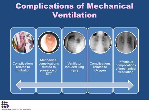 mechanical ventilation | Complications of Mechanical Ventilation - ppt ...