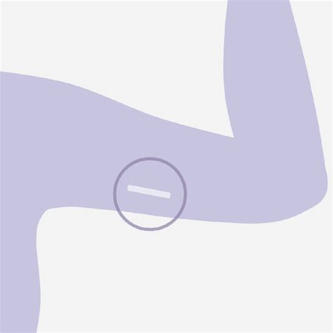 Contraceptive Implant Removal — Fast & Effective Service UK