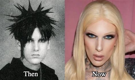 Jeffree Star Plastic Surgery Before and After Photos - Latest Plastic ...