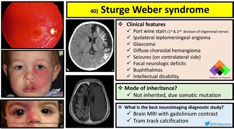 Sturge Weber Mri