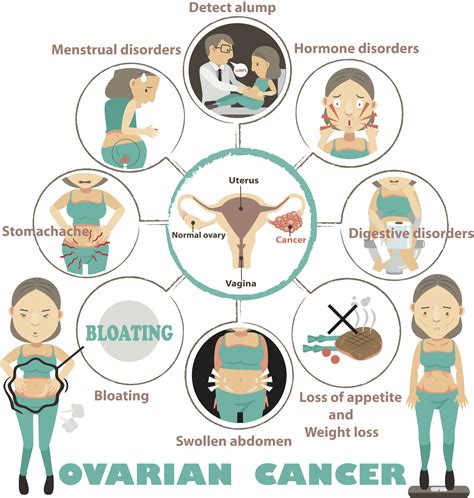 Ovarian Cancer Symptoms Early