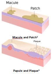 Approach to Skin Lesions | Learn Pediatrics